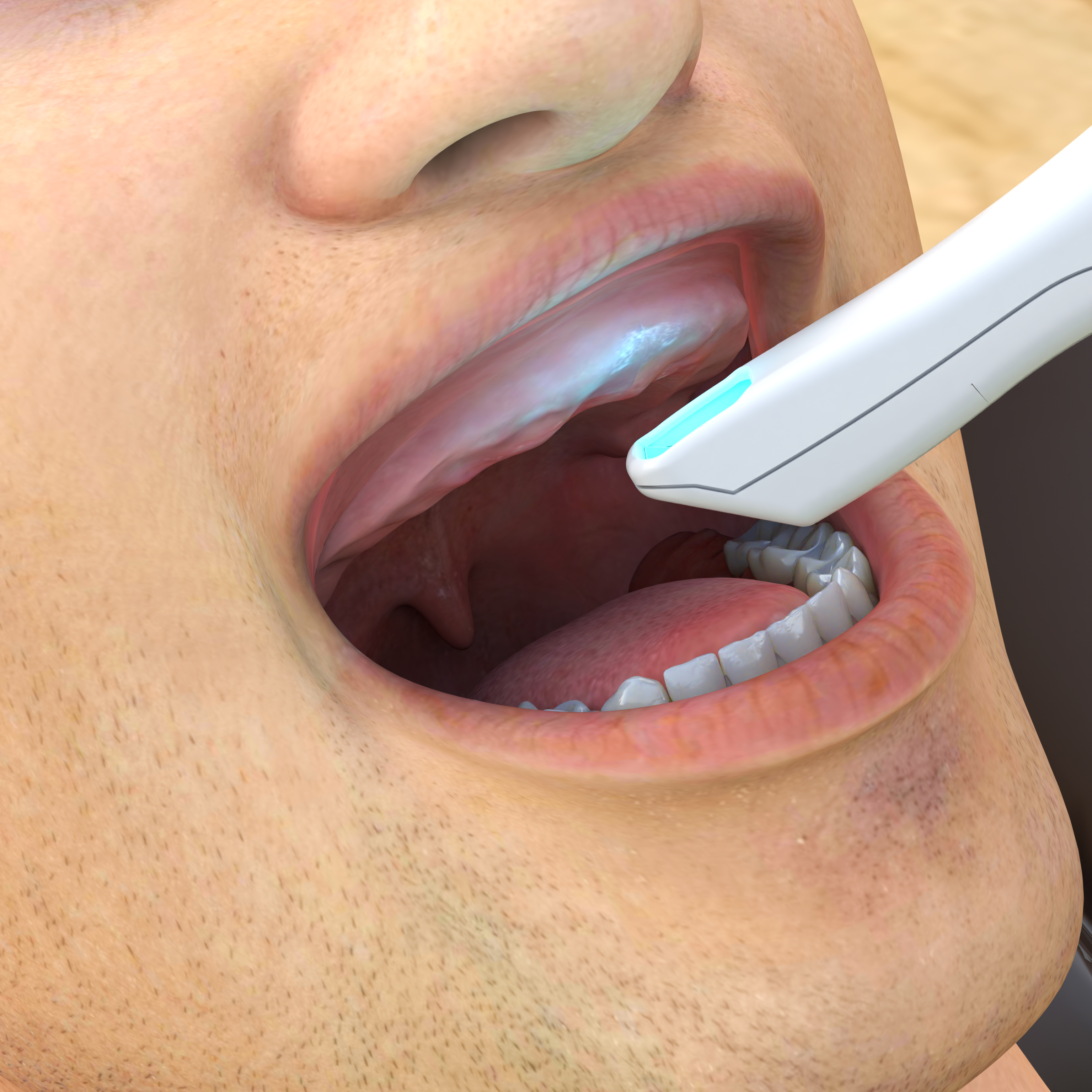 Digital Dentistry Edentulous